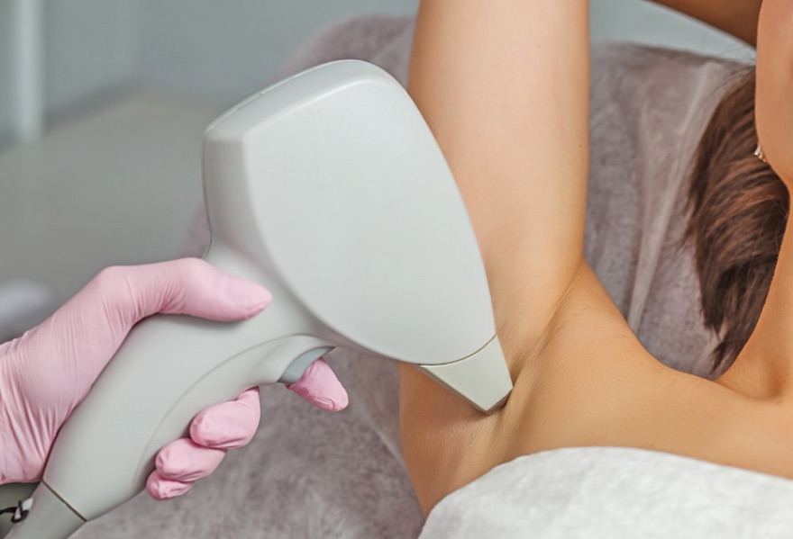 Epilazione Laser fa male o no