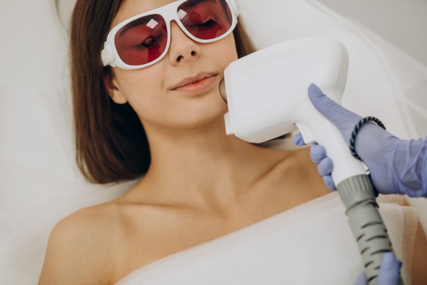 Quante sedute di epilazione laser viso