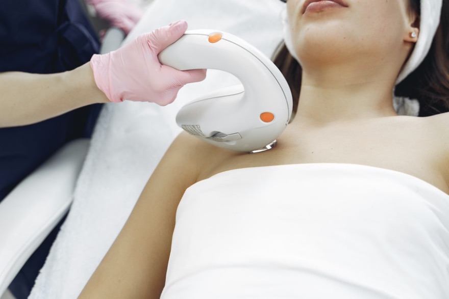 epilazione laser vs luce pulsata