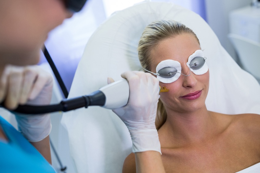 seduta di depilazione laser viso
