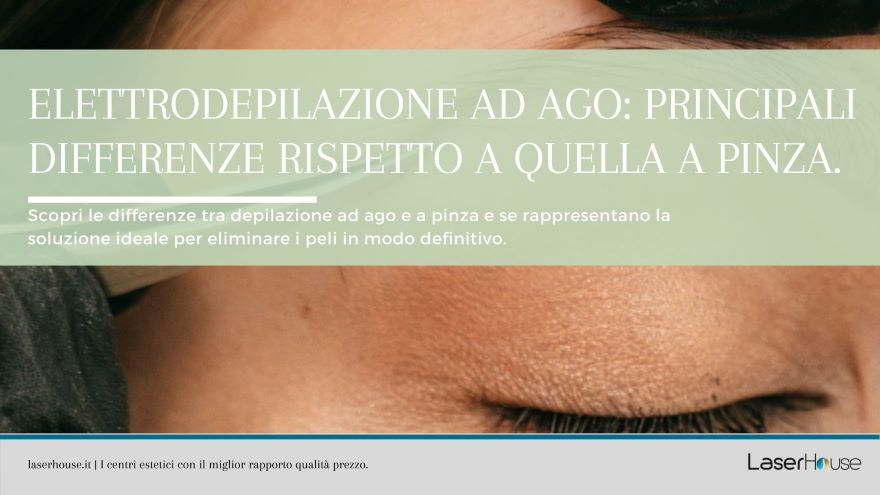 elettrodepilazione ad ago e differenze con il sistema a pinza