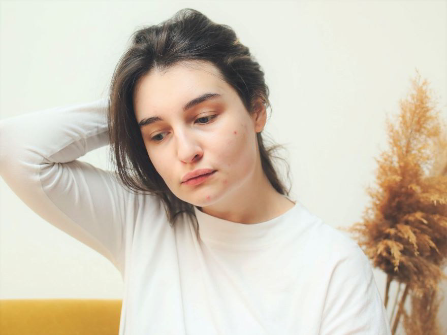 ragazza triste per la comparsa dei brufoli dopo la ceretta