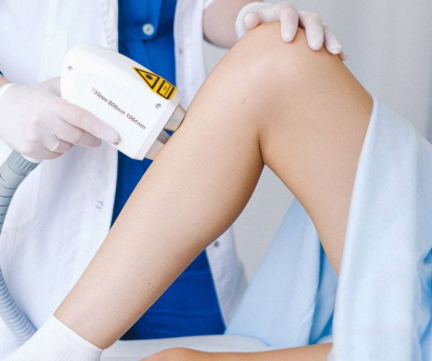 seduta di laser alle gambe
