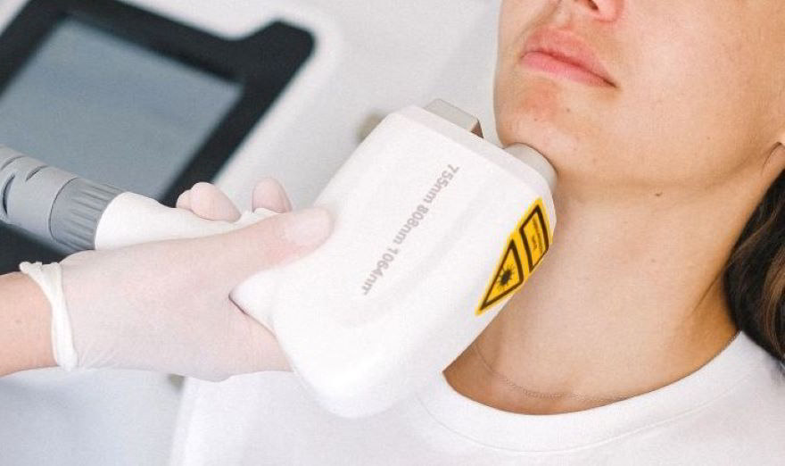 trattamento laser al viso