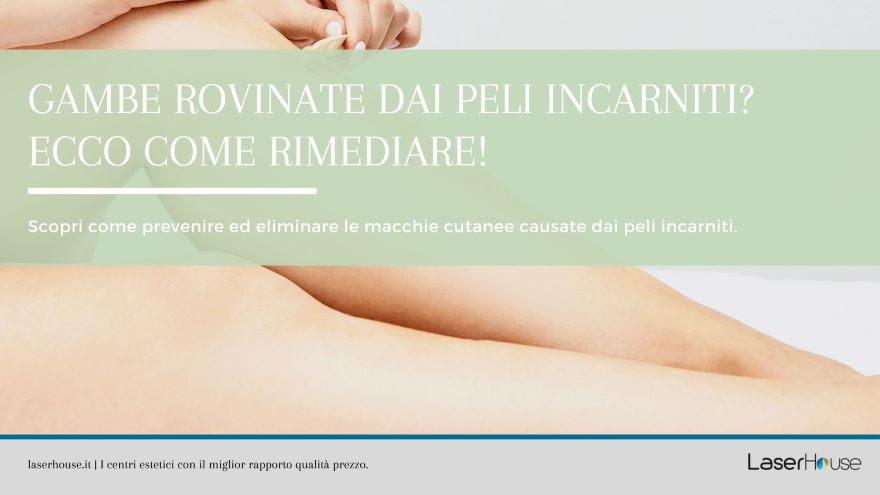 rimedi per le gambe rovinate dai peli incarniti