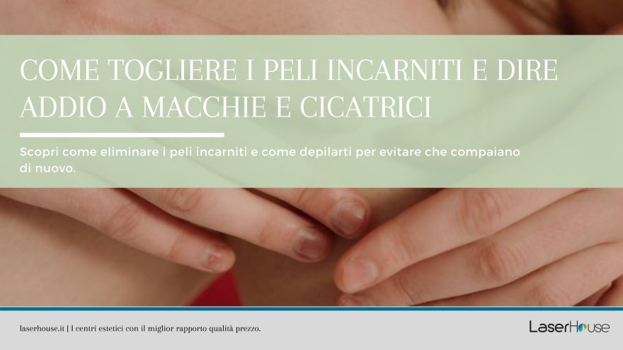 come togliere i peli incarniti