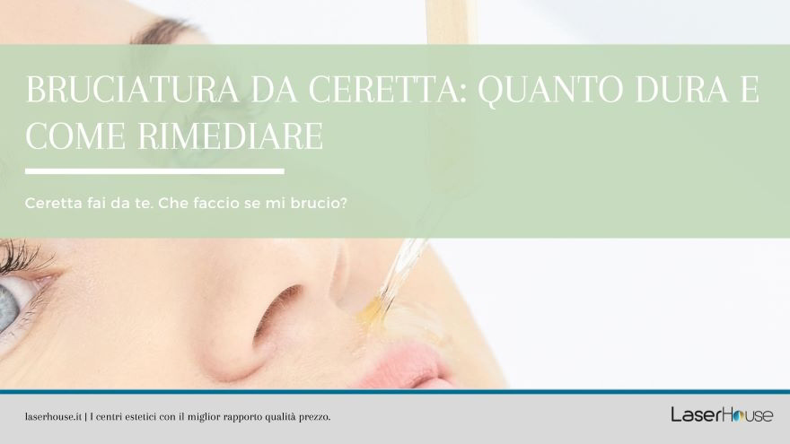 bruciatura da ceretta