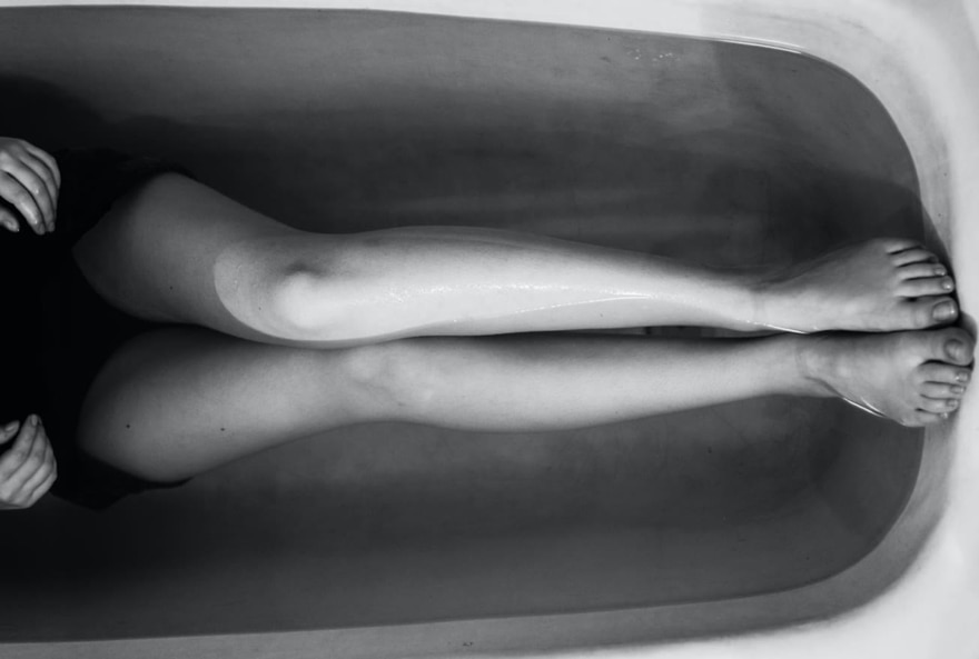 Gambe dopo epilazione laser