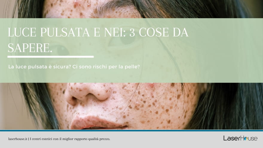 La luce pulsata sui nei è sicura?