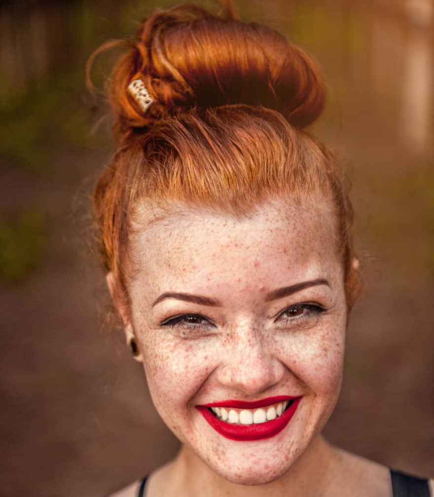 La luce pulsata non è efficace con la peluria rossa