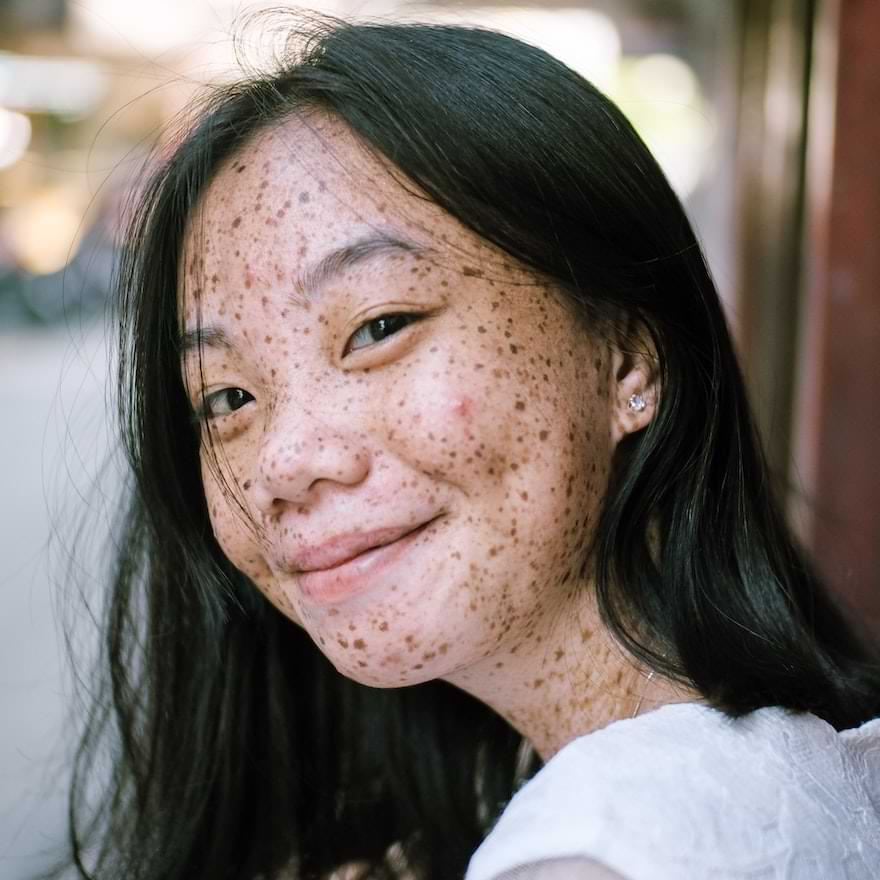 ragazza con lentiggini sul viso senza peli superflui dopo l