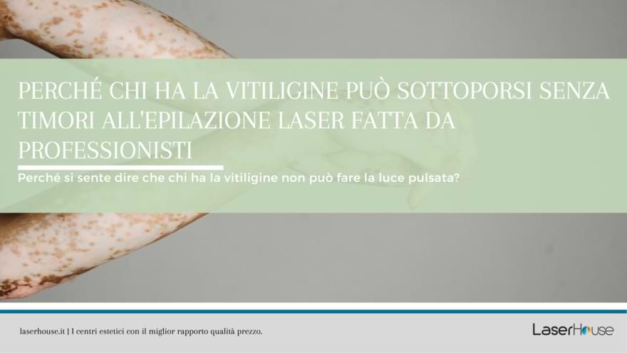 vitiligine e epilazione laser: sono compatibili?