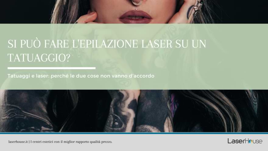 epilazione laser su tatuaggi