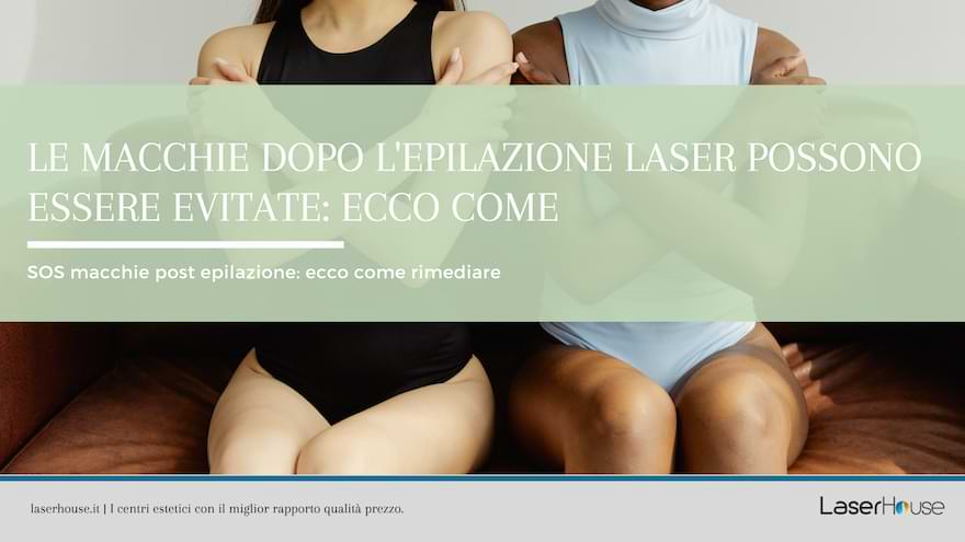 macchie dopo epilazione laser