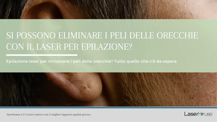 eliminare peli orecchie laser
